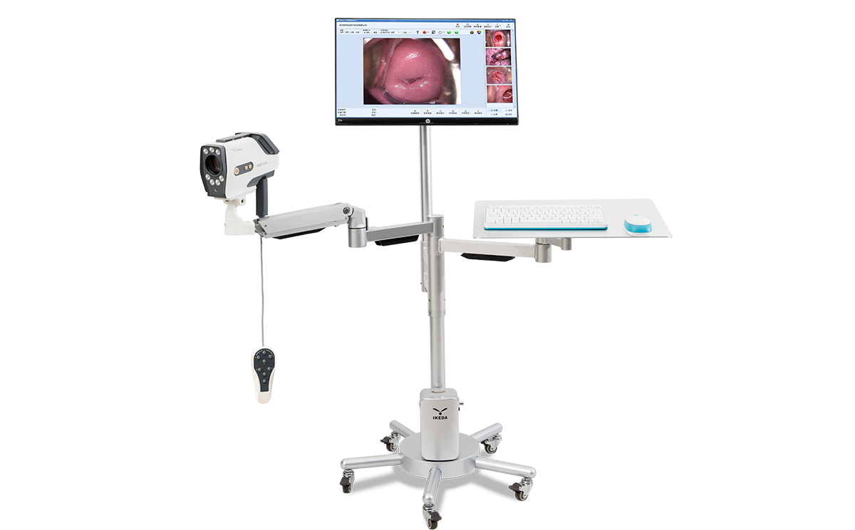數碼電子陰道鏡如何選擇？根據醫院等級需求選擇合適的